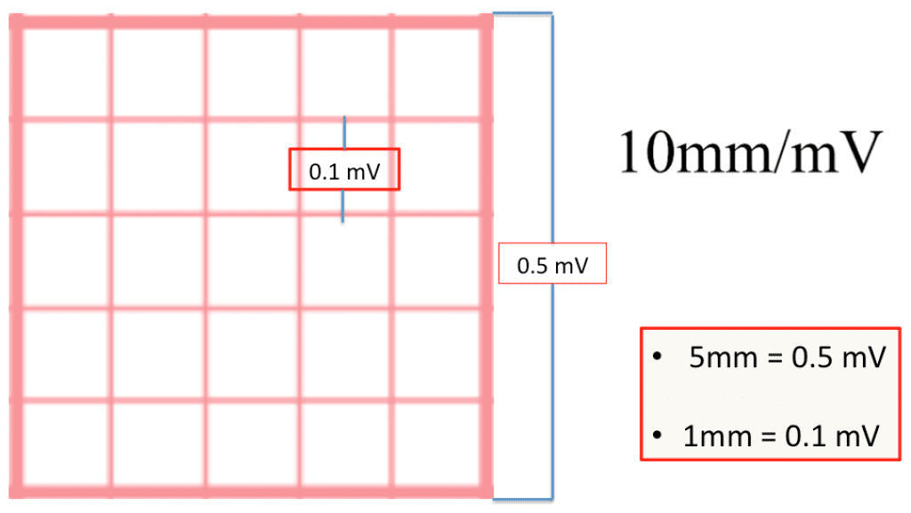 What Does Low Voltage Mean On An Ekg
