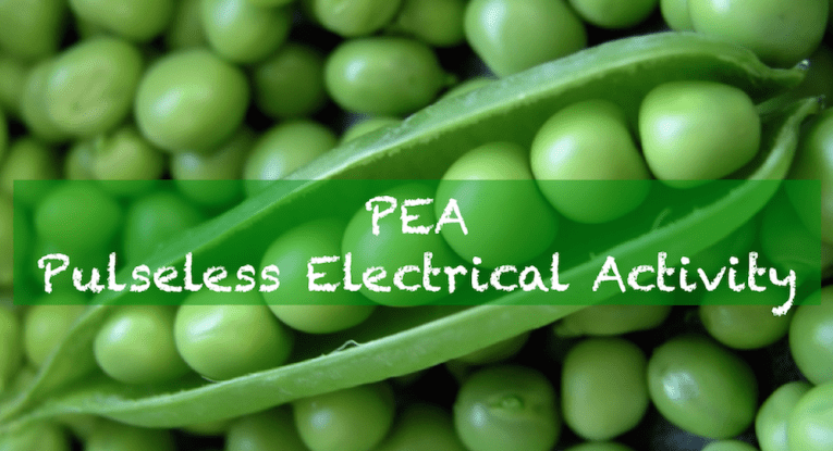 define pulseless electrical activity