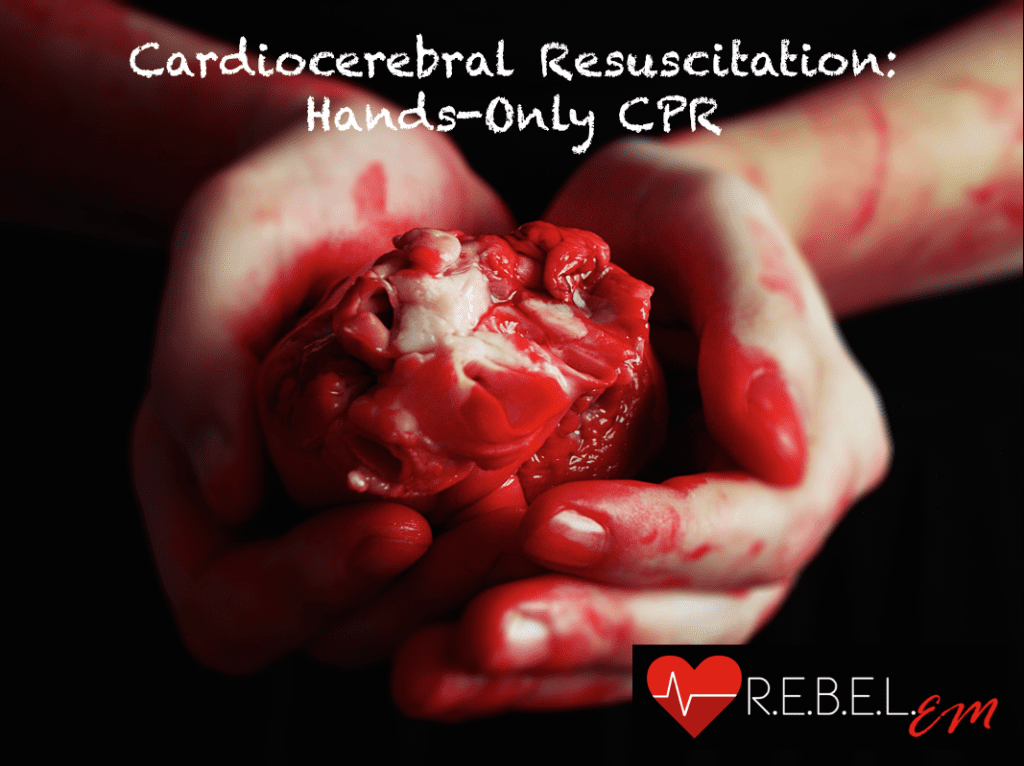 Cardiocerebral Resuscitation