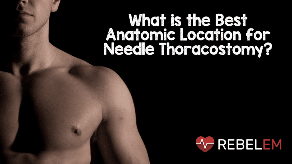 what-is-the-best-anatomic-location-for-needle-thoracostomy-rebel-em