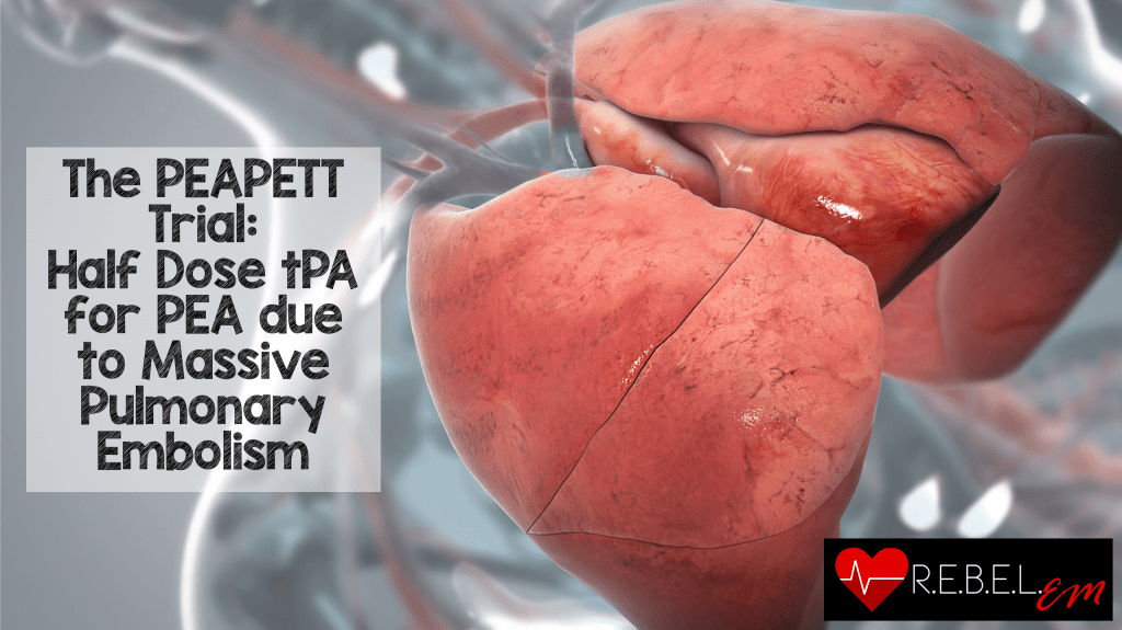 peapett-trial