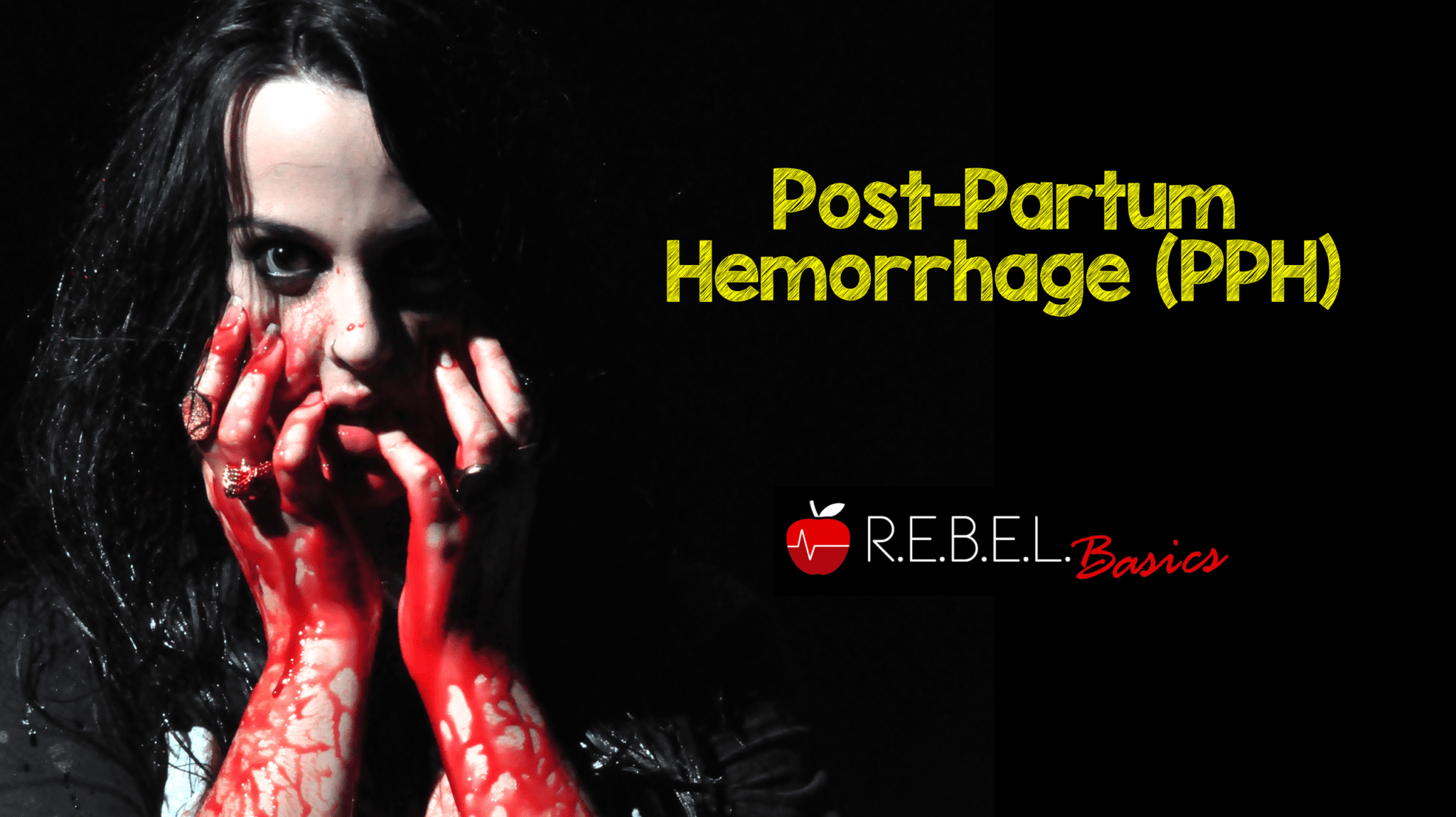 Post Partum Hemorrhage Rebel Em Emergency Medicine Blog
