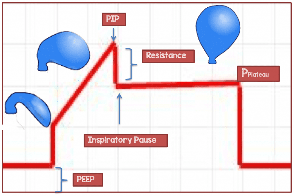 pip in mechanical ventilation