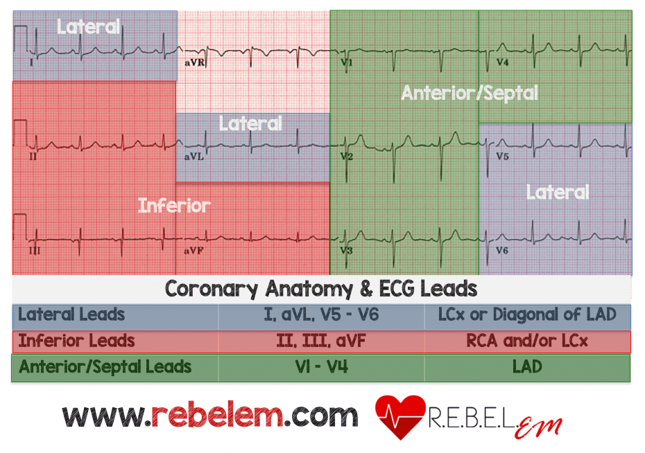 Rebellion In Em Stemi Equivalents By Tarlan Hedayati Md Rebel