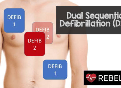 dual sequential defib