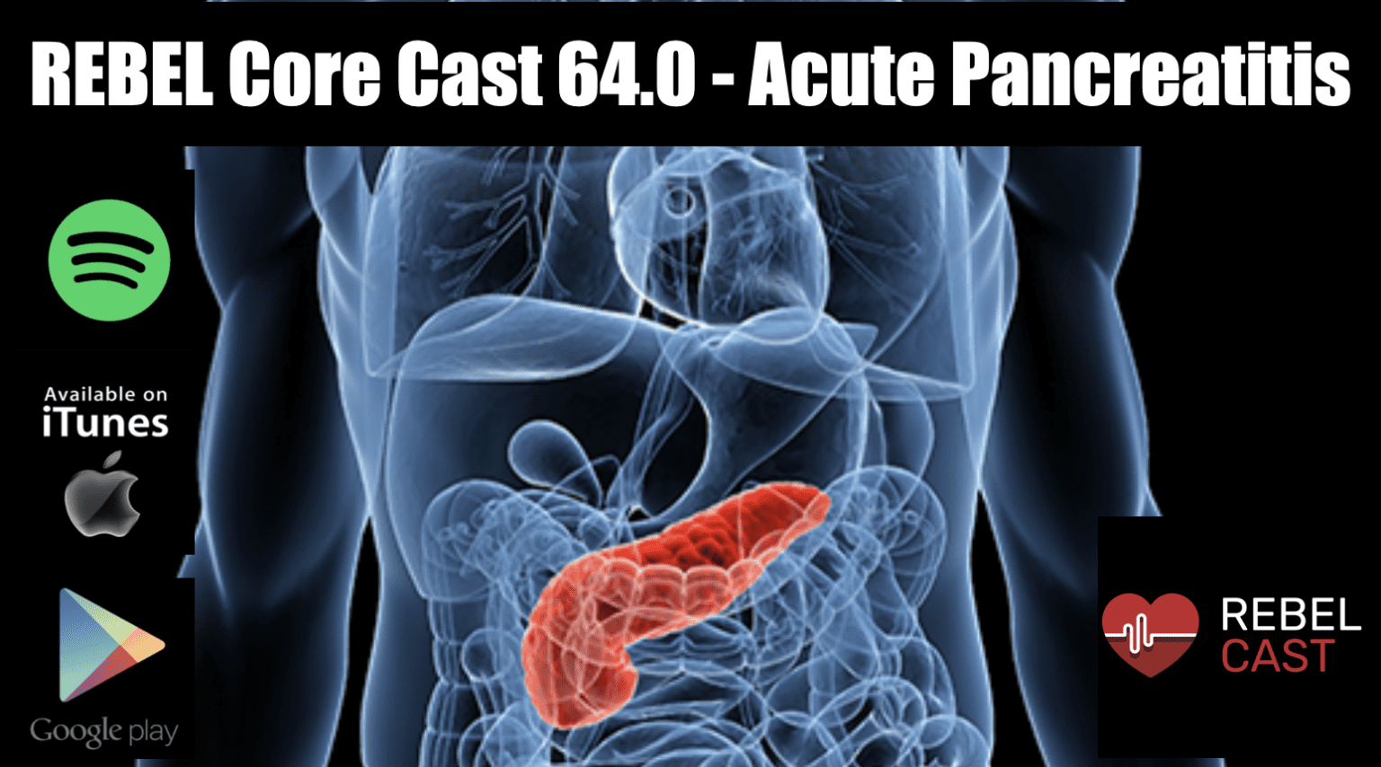 Rebel Core Cast Acute Pancreatitis Rebel Em