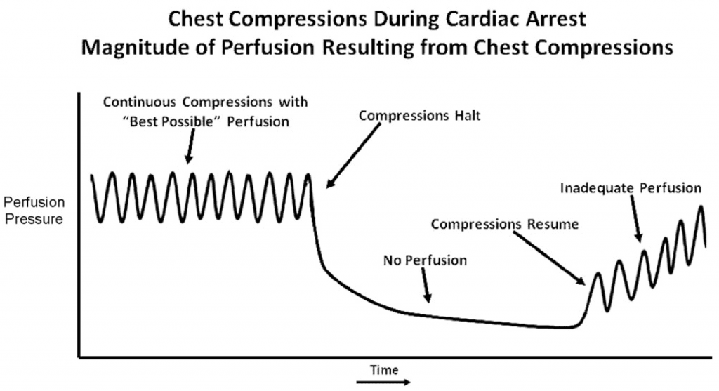 Cardiac Perfusion and Interruptions in CPR
