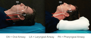 Ear-to-Sternal Notch Position