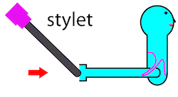 Replace Stylet