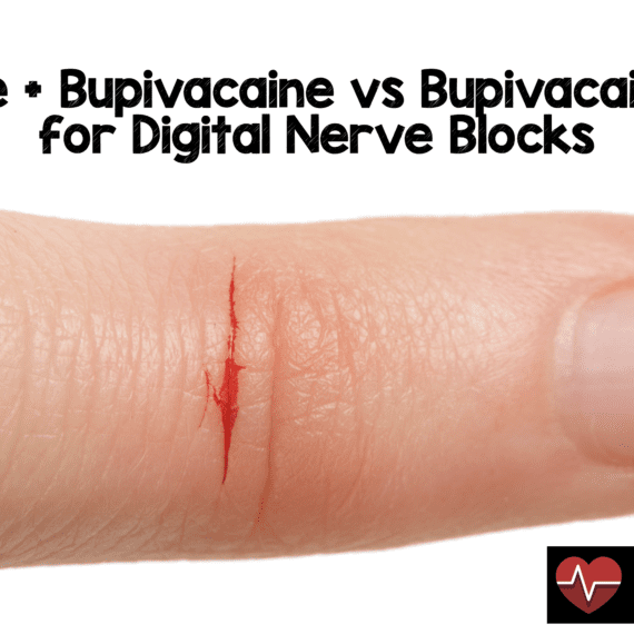 Lidocaine + Bupivacaine vs Bupivacaine Alone for Digital Nerve Blocks