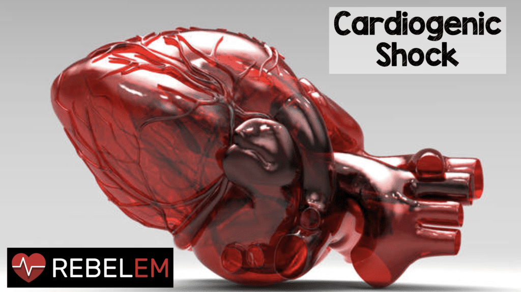 Cardiogenic Shock REBEL EM Emergency Medicine Blog