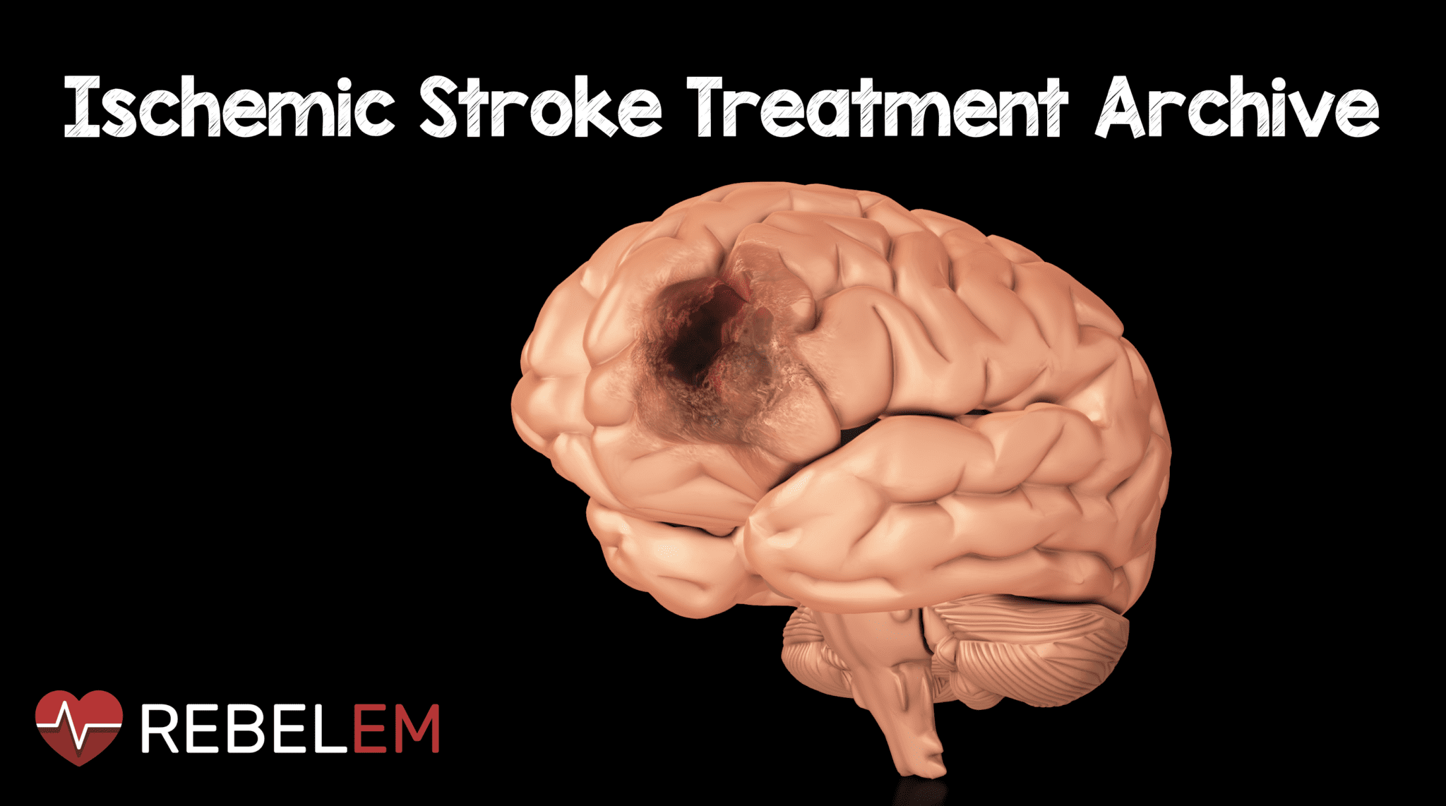 ischemic-stroke-treatment-archive-rebel-em-emergency-medicine-blog