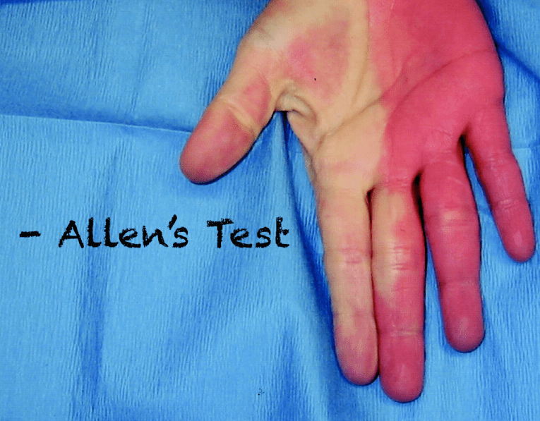 Screen Shot 20151102 at 4.16.13 PM REBEL EM Emergency Medicine Blog