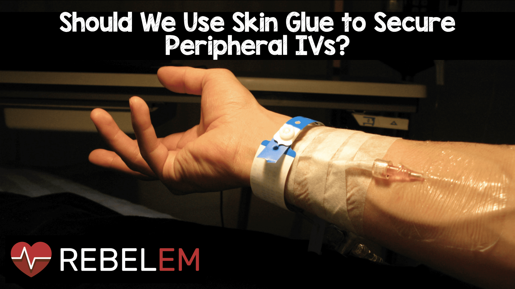 Should We Use Skin Glue to Secure Peripheral IVs? - REBEL EM
