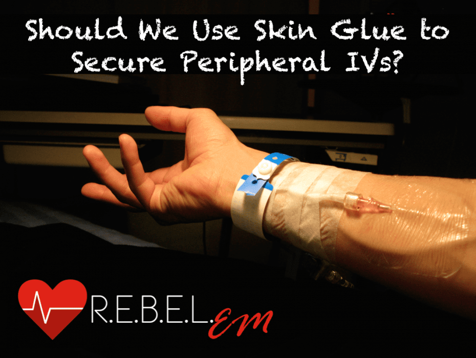 v2 Peripheral IVs REBEL EM Emergency Medicine Blog