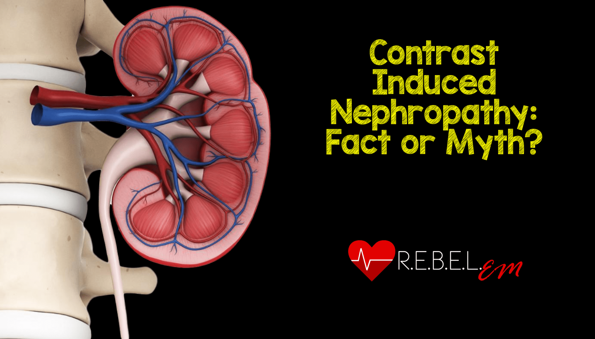 Contrast Induced Nephropathy CIN 