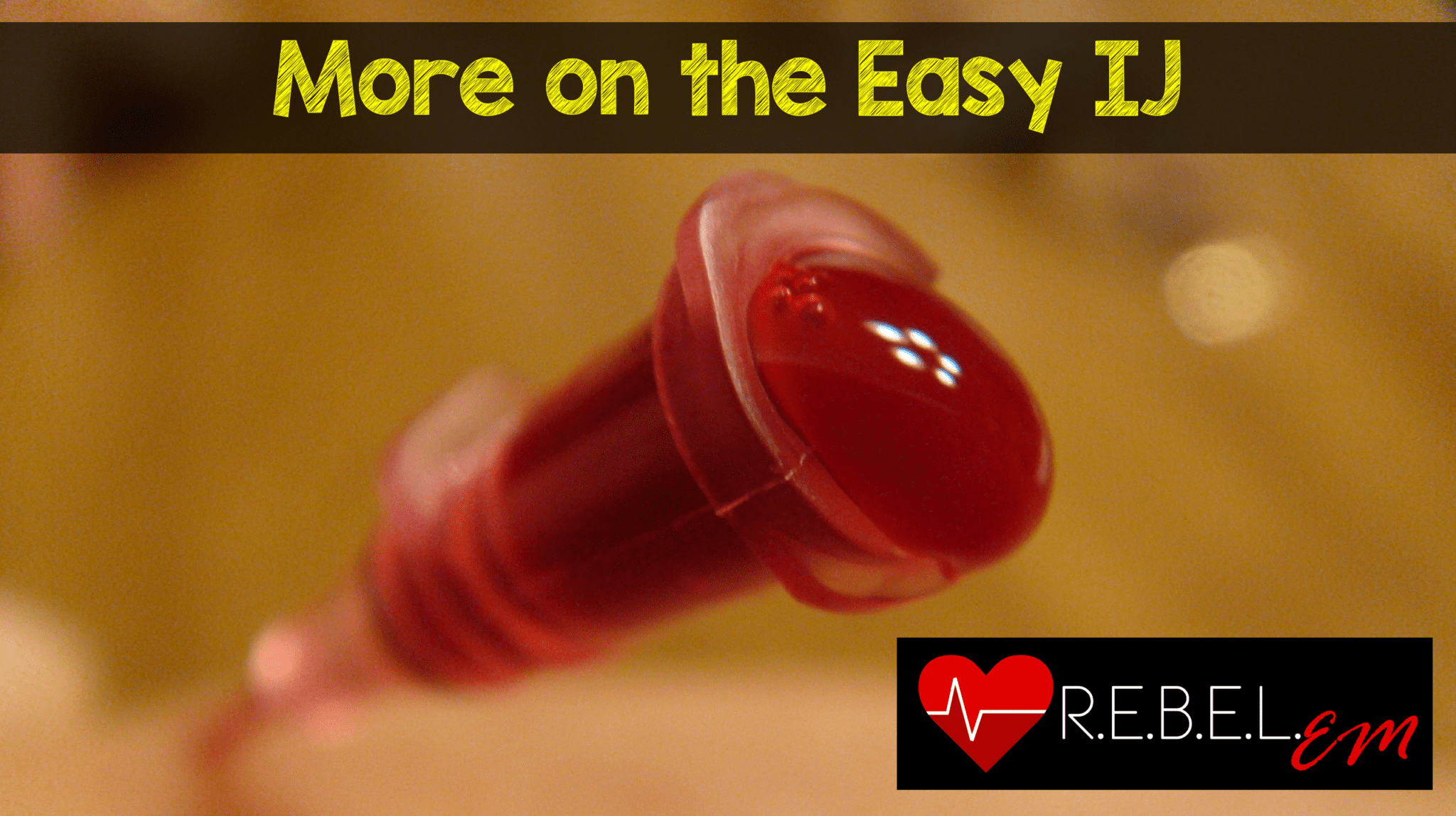 Should We Use Skin Glue to Secure Peripheral IVs? - REBEL EM - Emergency  Medicine Blog