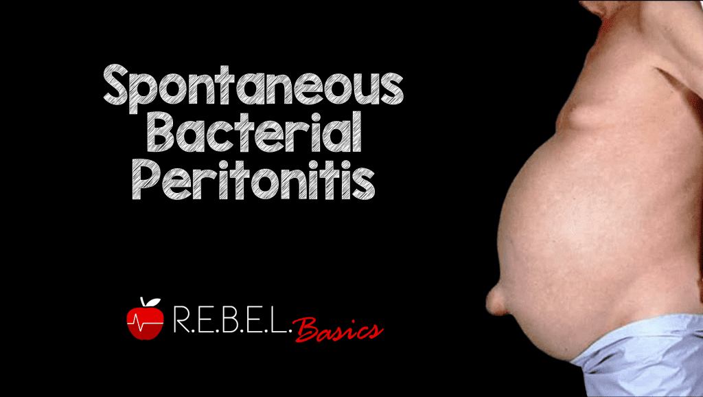 spontaneous-bacterial-peritonitis-rebel-em-emergency-medicine-blog