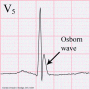 image1 - REBEL EM - Emergency Medicine Blog