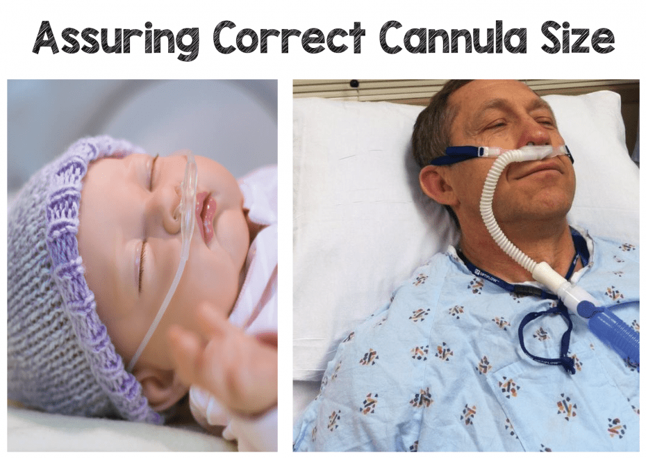 High Flow Nasal Cannula Hfnc Part How It Works Rebel Em Emergency Medicine Blog