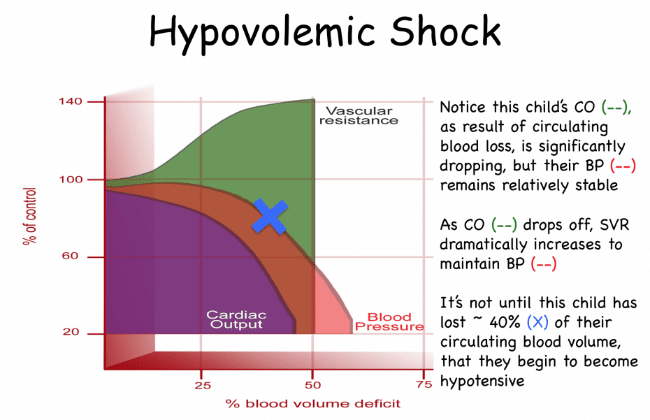 Approach to the Critically Ill Child Shock REBEL EM Emergency