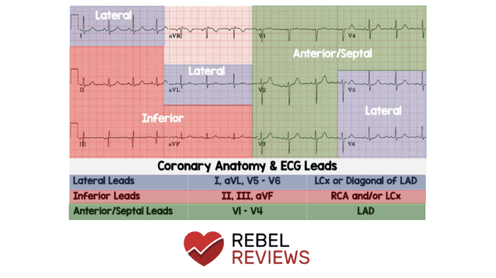 Coronary Anatomy & ECG Leads - REBEL EM - Emergency Medicine Blog