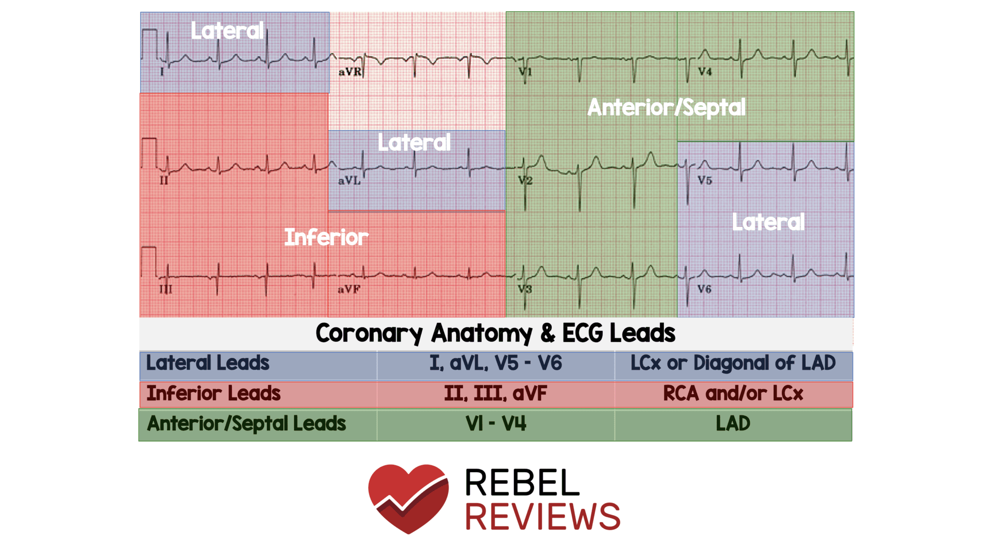 Coronary Anatomy  U0026 Ecg Leads - Rebel Em
