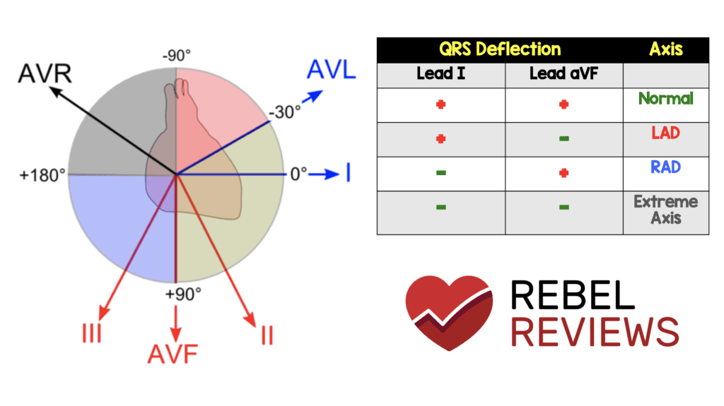 What Is Vertical Axis On Ecg