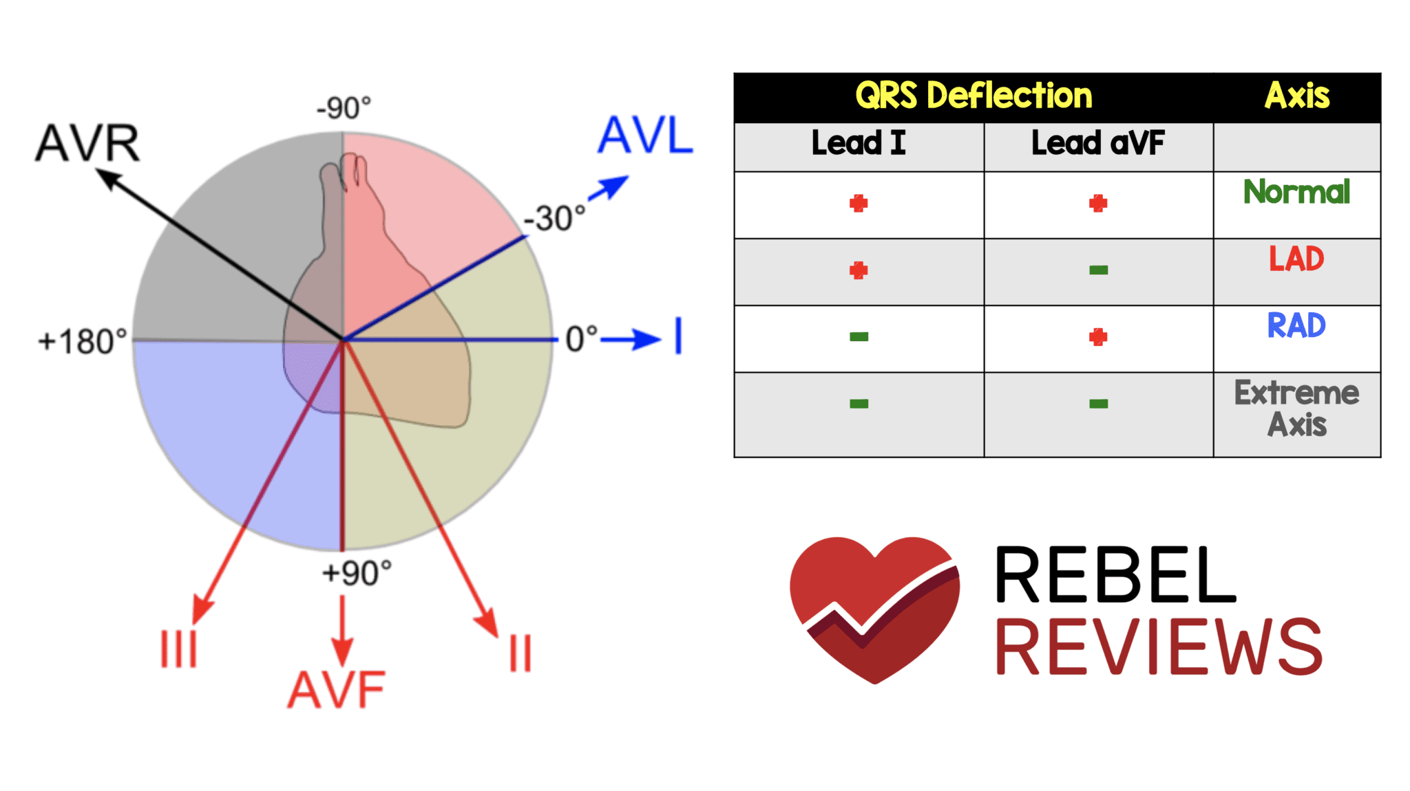 ecg-basics-axis-deviation-and-p-wave-abnormalities-causes