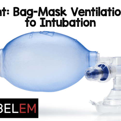 PreVent BagMask Ventilation Prior to Intubation MEDTAC