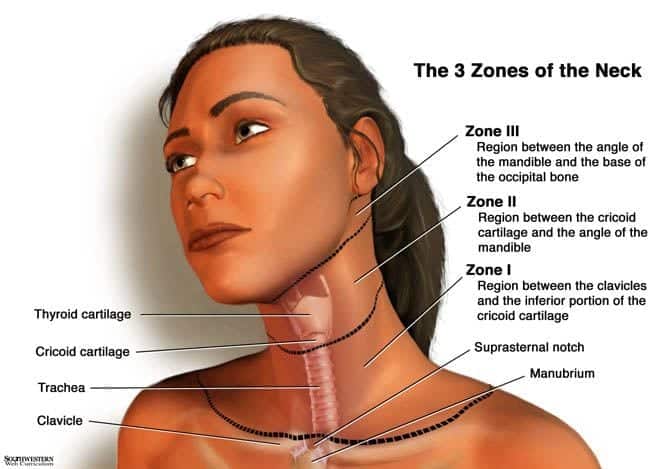 REBEL Core Cast 17 0 Penetrating Neck Trauma MED TAC International 