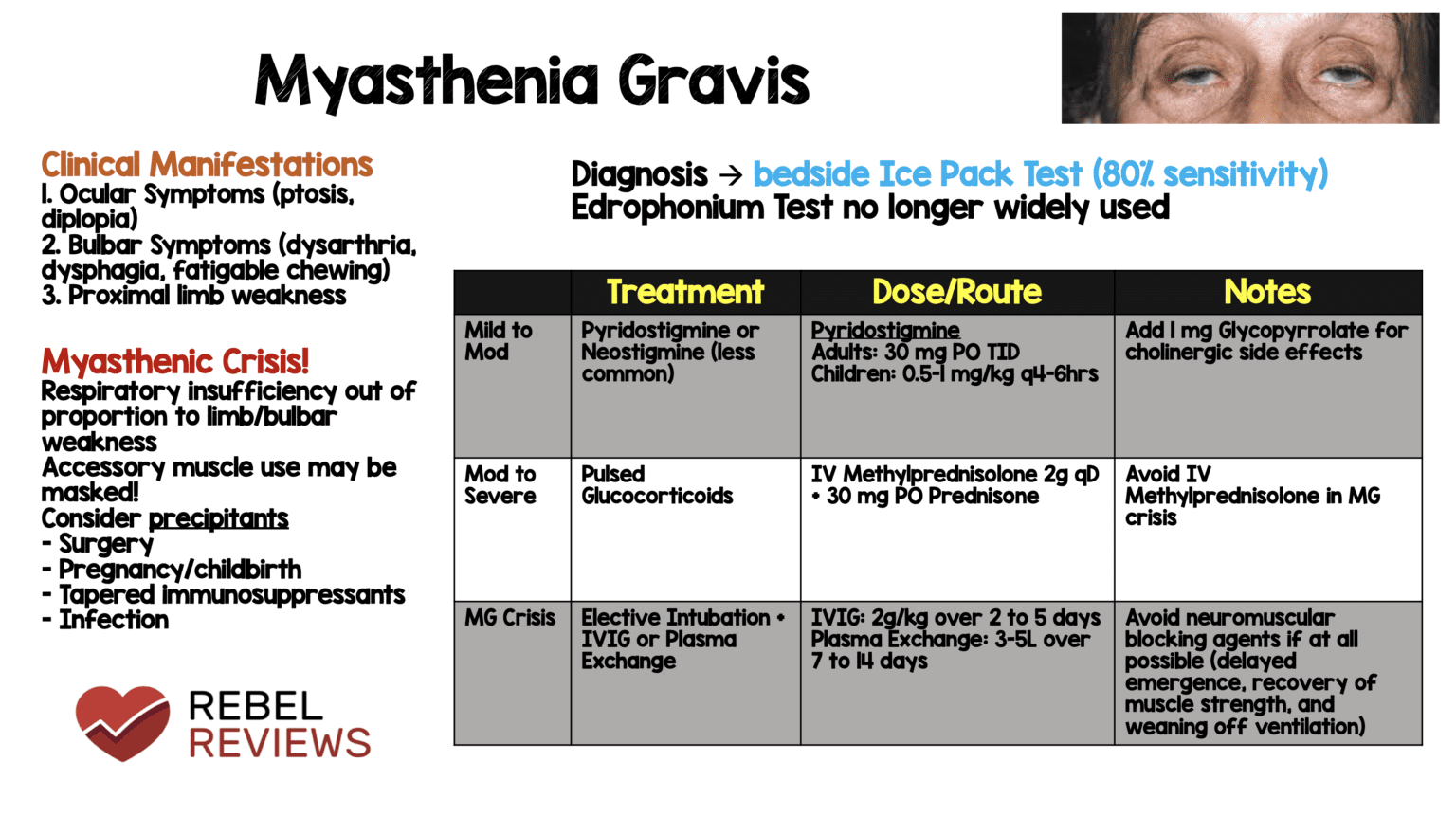 myasthenia-gravis-rebel-em-emergency-medicine-blog