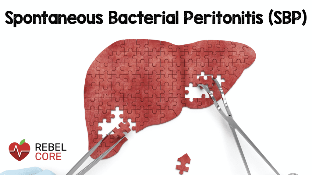 Spontaneous Bacterial Peritonitis (SBP)  REBEL EM  Emergency Medicine