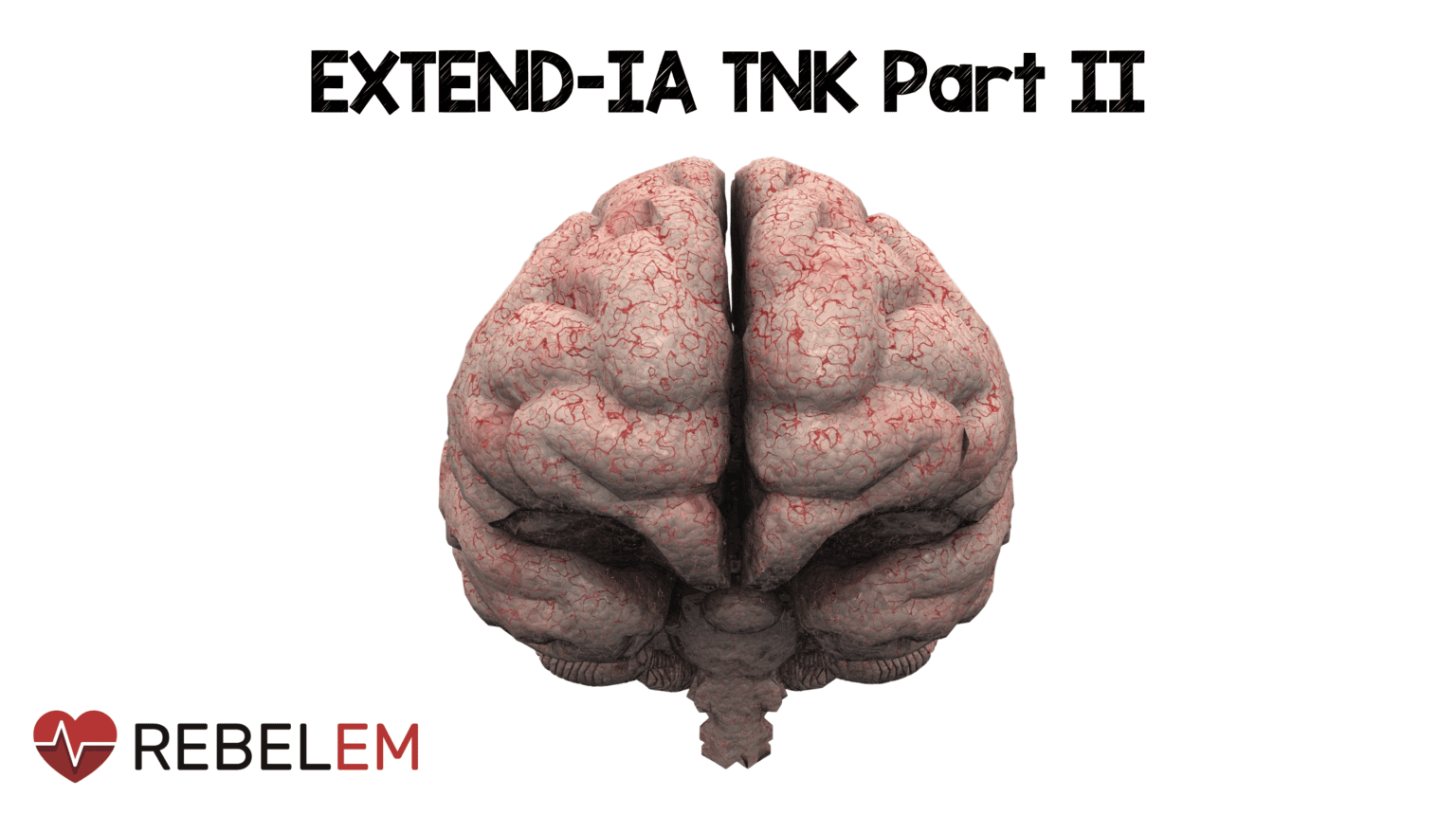 Tnk Objective What Does Tnk Mean? : TNK Abbreviation Meaning – UKCDM