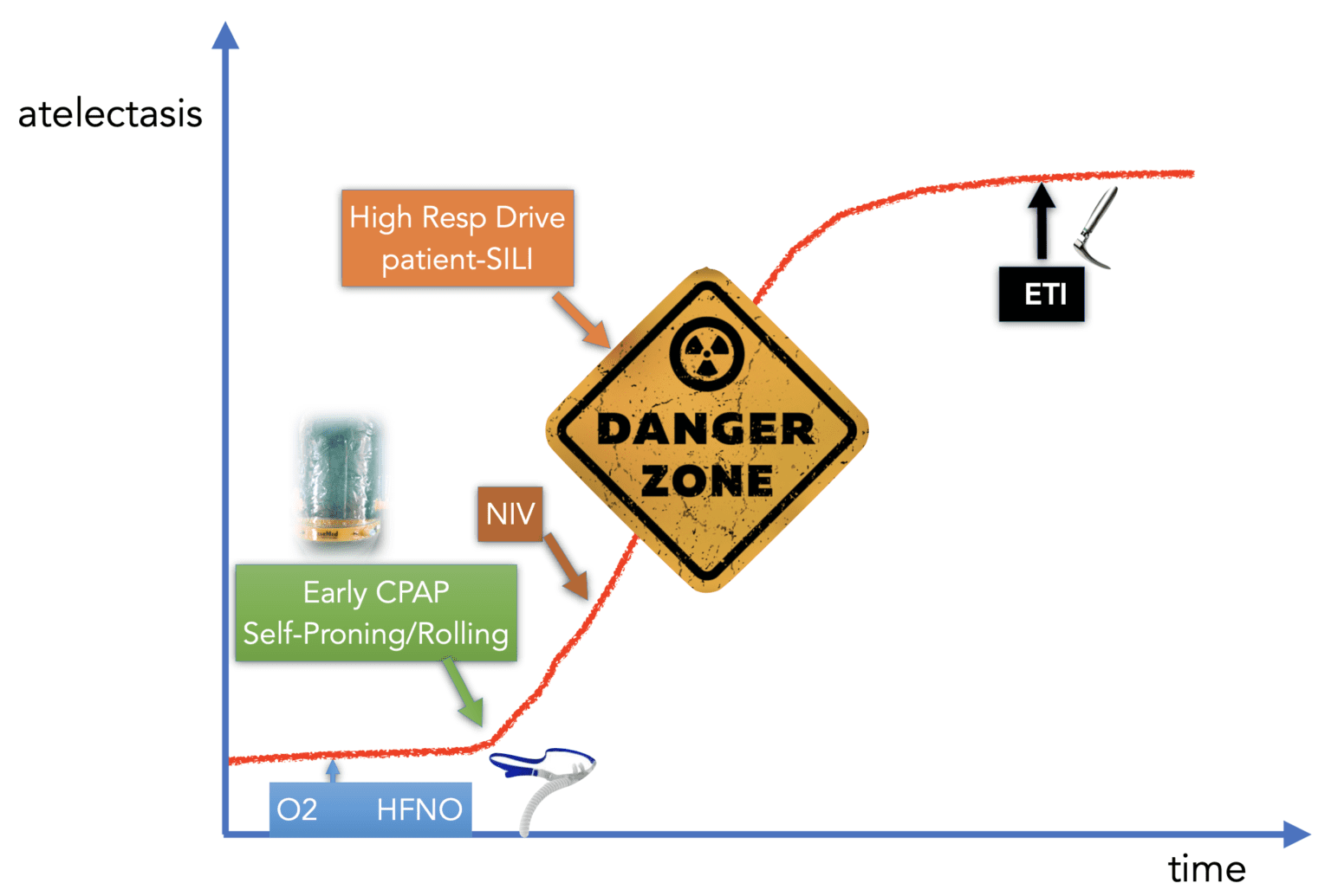 Helmet CPAP vs Venturi Mask in Severe Acute Hypoxemic Respiratory