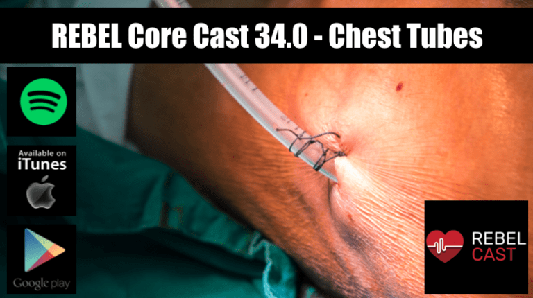 REBEL Core Cast 34.0 - Chest Tubes - REBEL EM - Emergency Medicine Blog