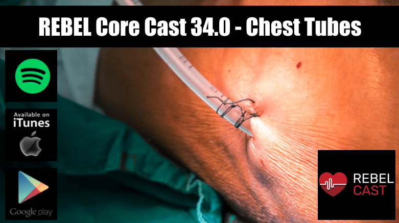 REBEL Core Cast 34.0 - Chest Tubes - REBEL EM - Emergency Medicine