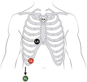 Pearls from ResusX Rewired 2020 - REBEL EM - Emergency Medicine Blog