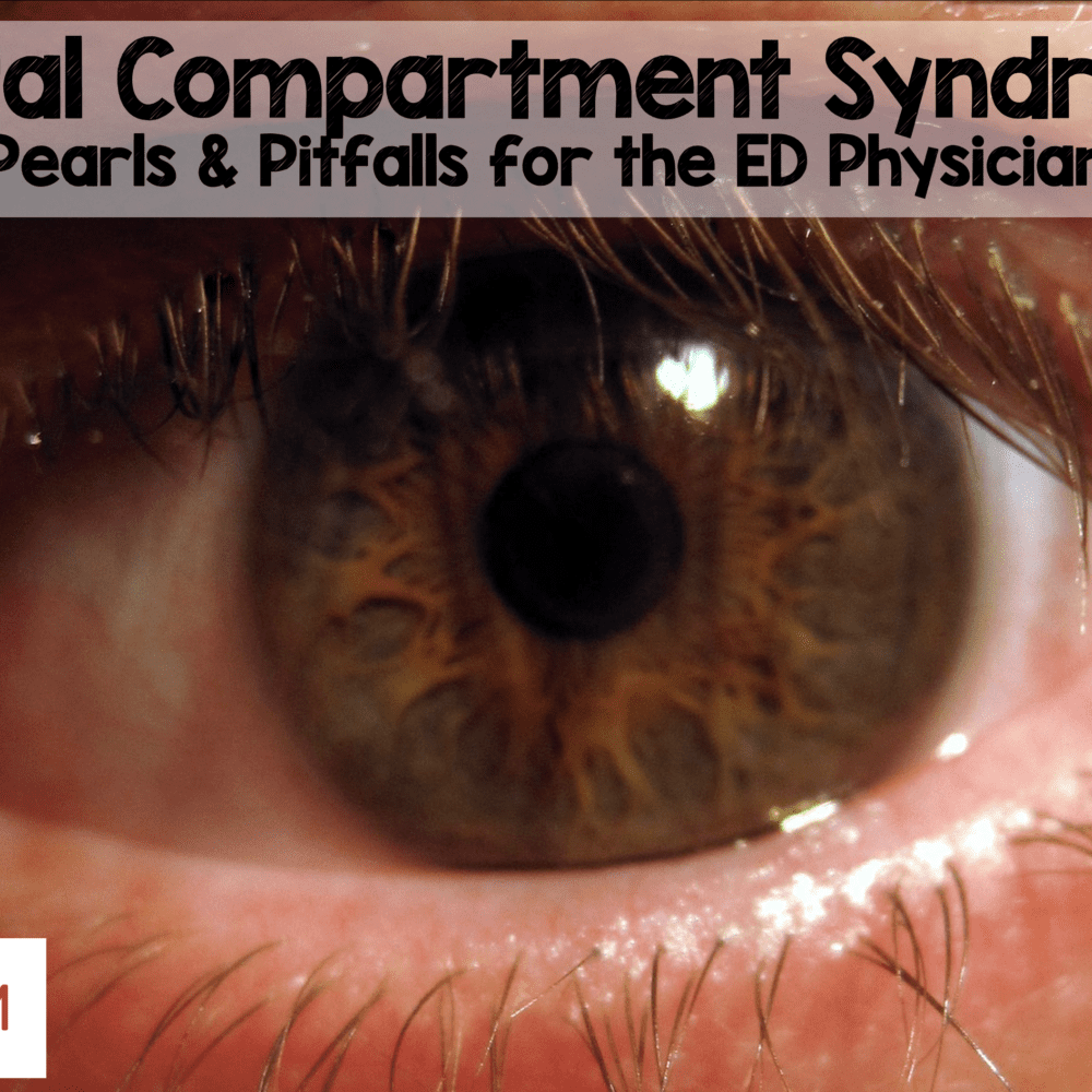 Orbital Compartment Syndrome Pearls and Pitfalls for the ED Physician