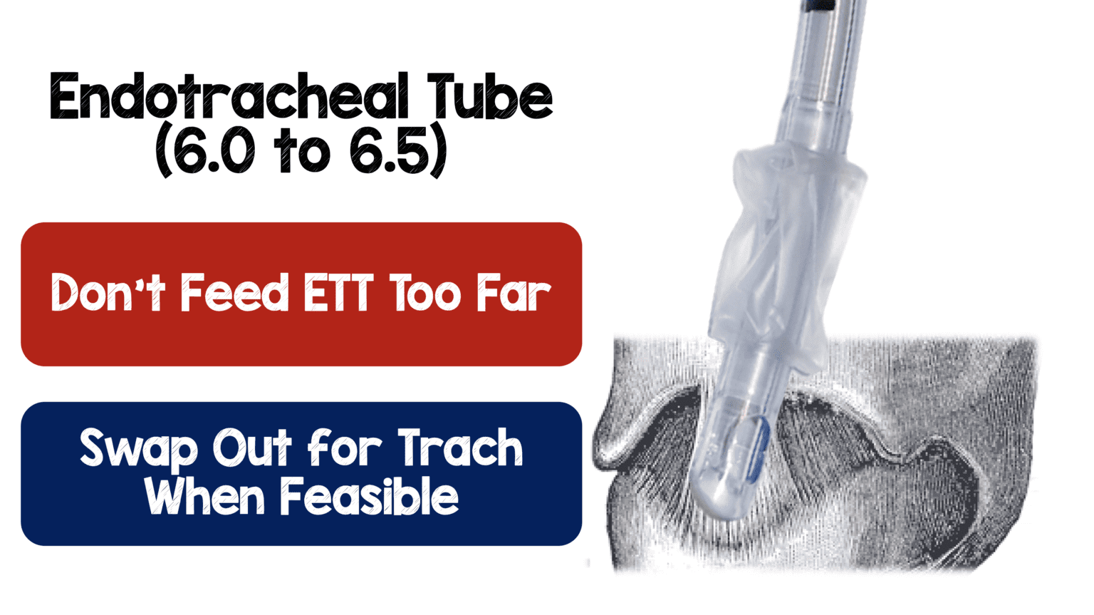 BougieAssisted Cricothyrotomy REBEL EM Emergency Medicine Blog