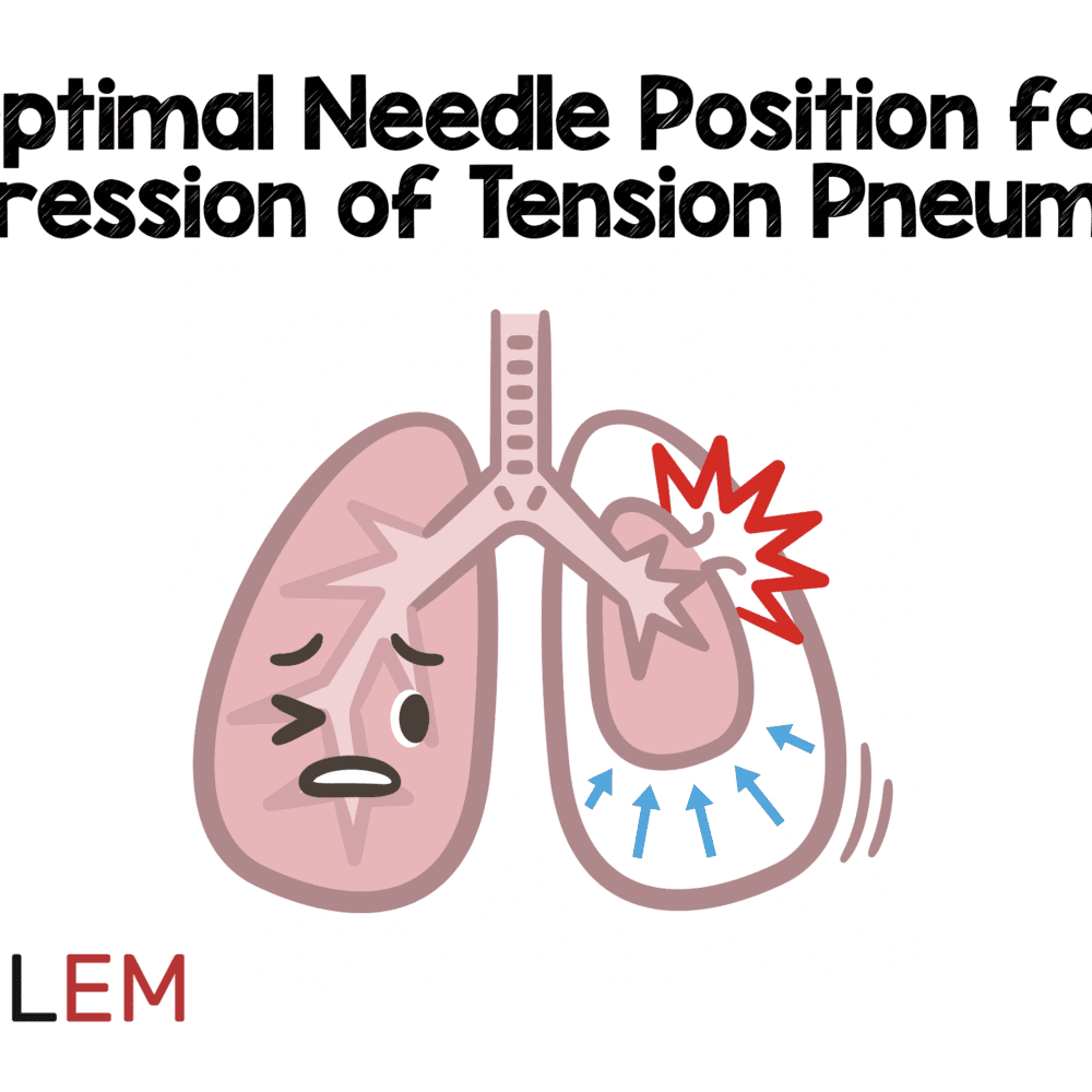 Optimal Needle Position For Decompression Of Tension Pneumothorax Med