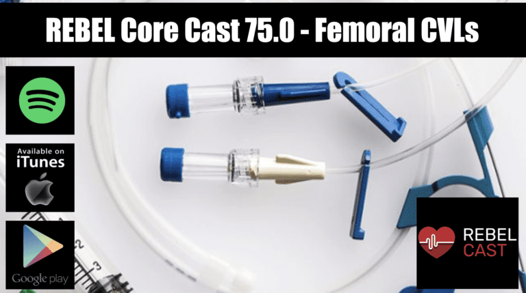 Rebel Core Cast 750 Femoral Lines Rebel Em Emergency Medicine Blog