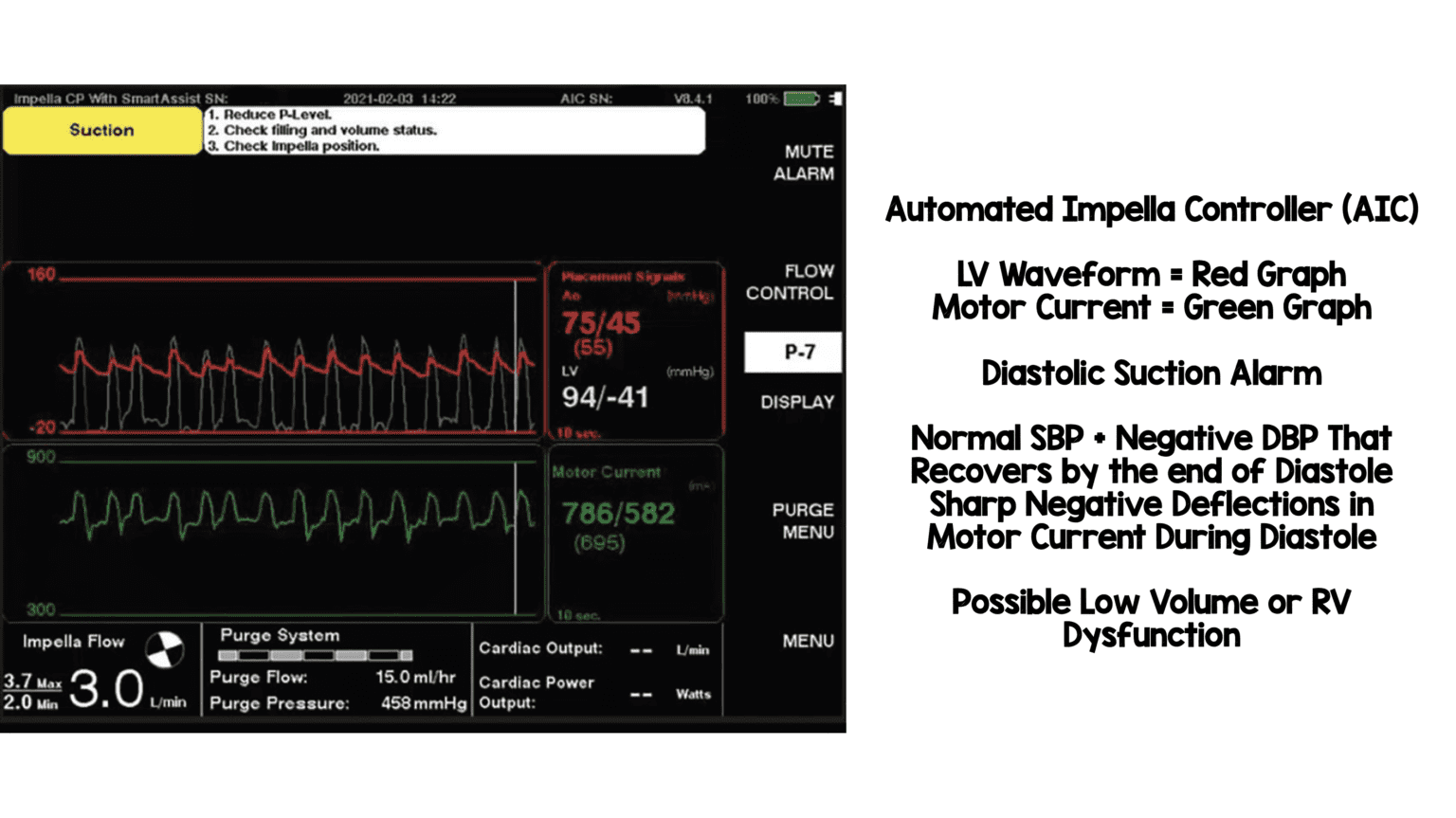 Impella Devices 101 MEDTAC International Corp.
