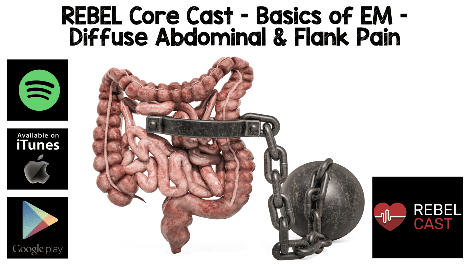 REBEL Core Cast Basics of EM Diffuse and Flank Abdominal Pain