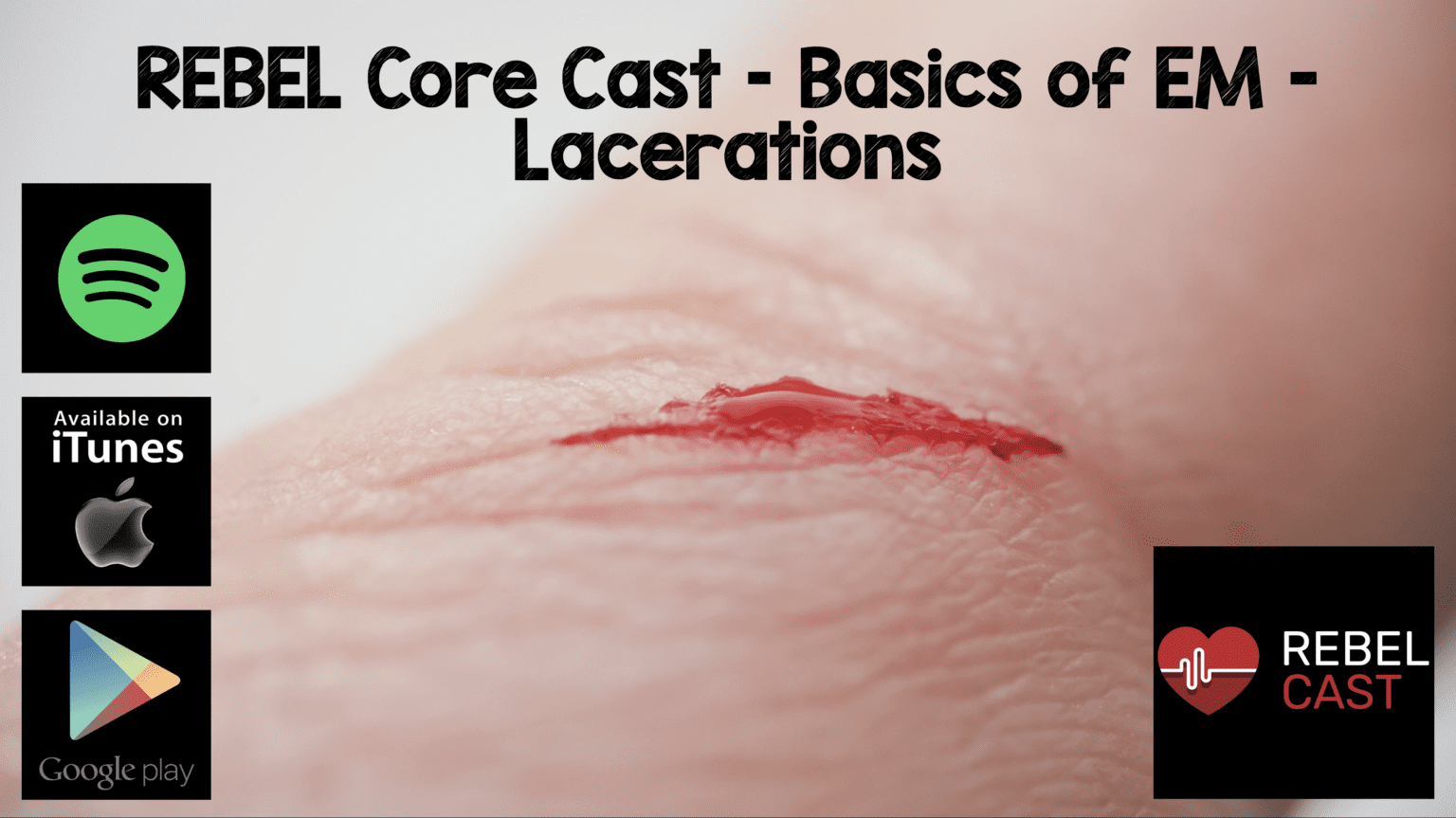 Rebel Core Cast Basics Of Em Lacerations Rebel Em Emergency