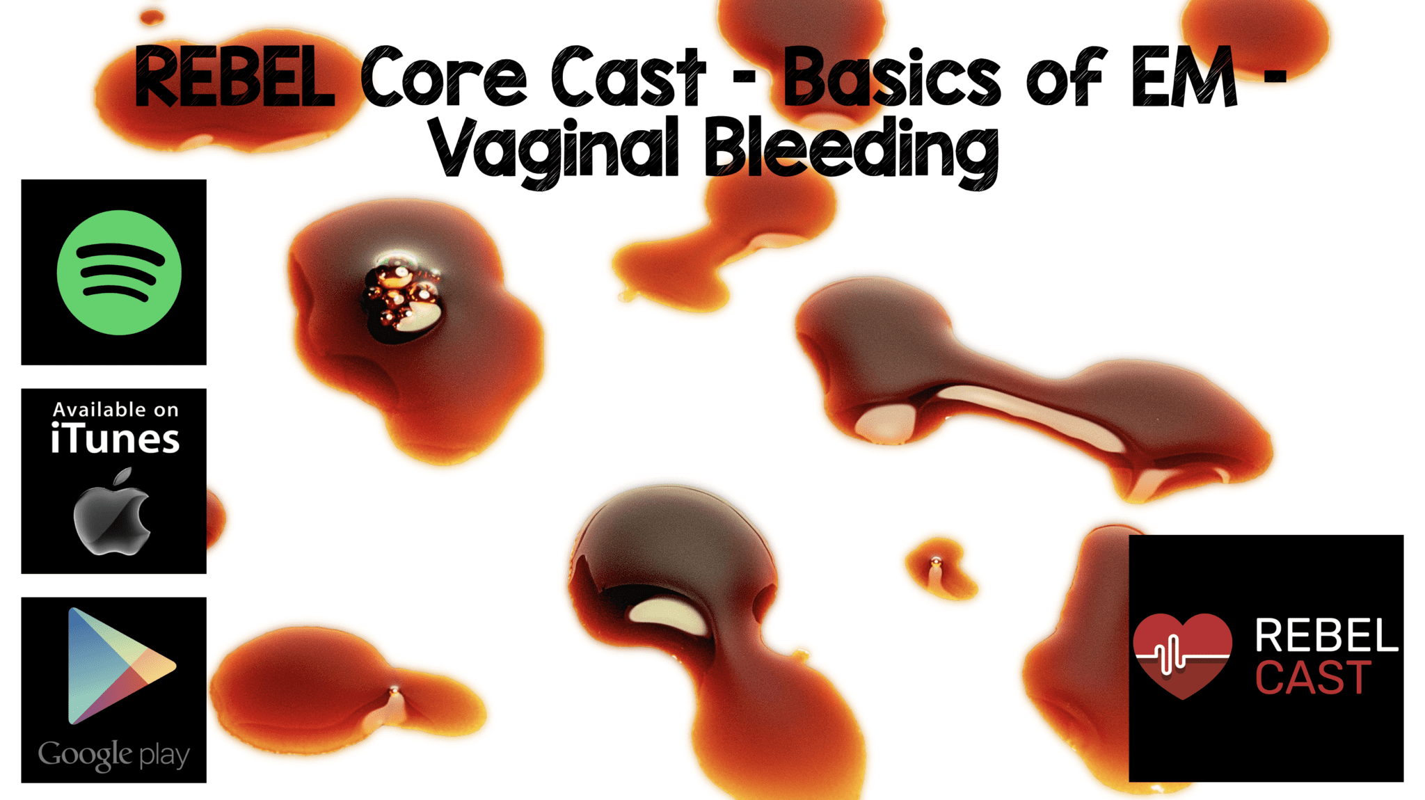 REBEL Core Cast - Basics of EM - Vaginal Bleeding - REBEL EM