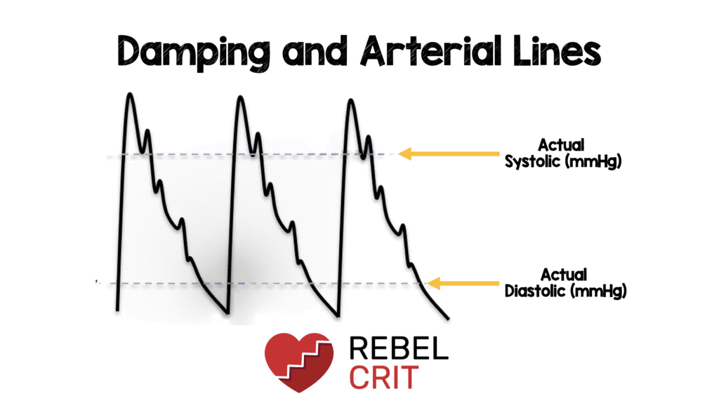 art line waveform whip