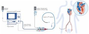 Impella Devices 101 - REBEL EM - Emergency Medicine Blog