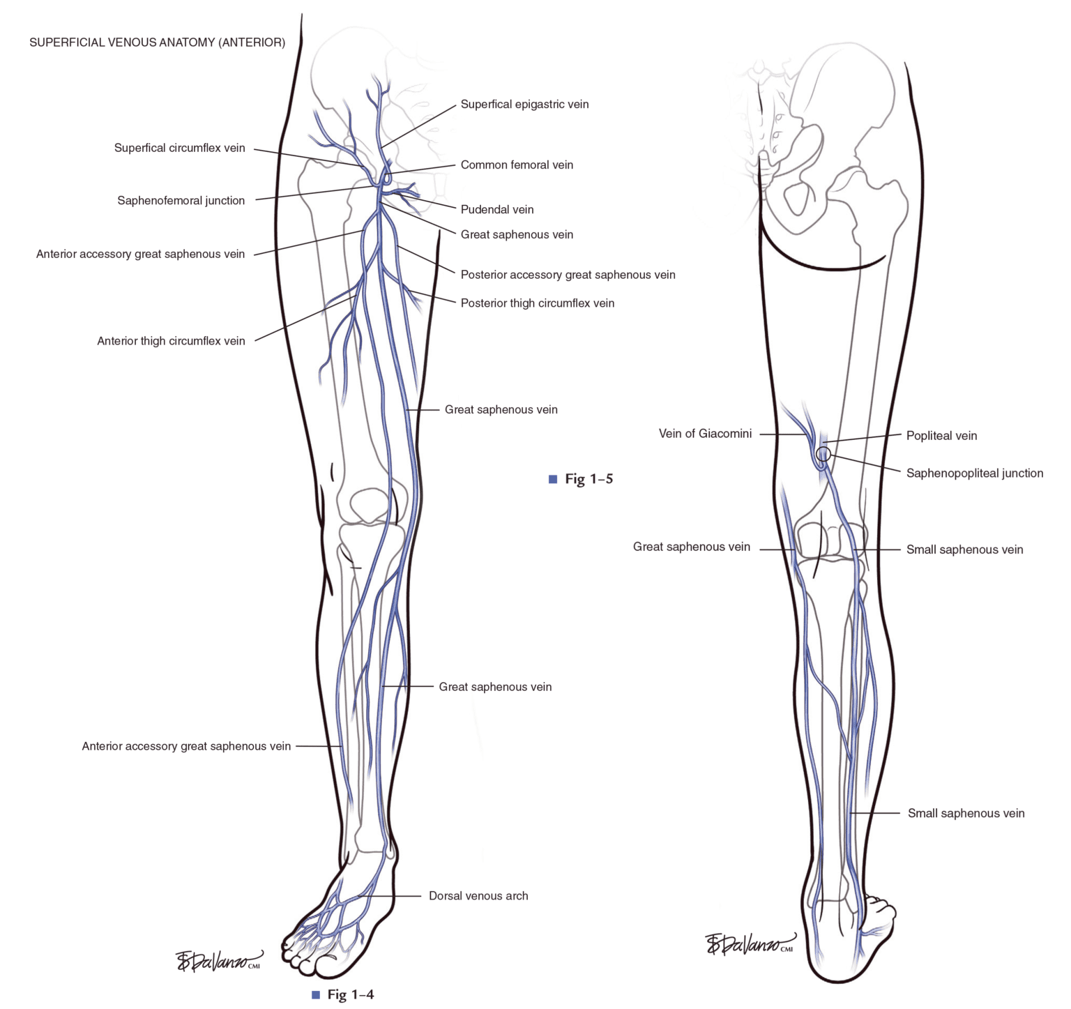 rebel-core-cast-85-0-superficial-venous-thrombosis-rebel-em