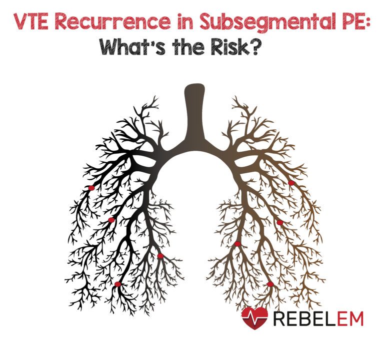 VTE Recurrence in Subsegmental PE What’s the Risk? MEDTAC